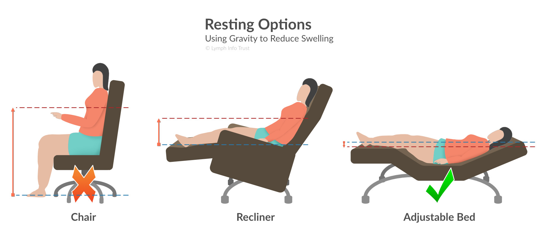 The best resting position is with your legs elevated, whether using pillows or a hospital-style bed.